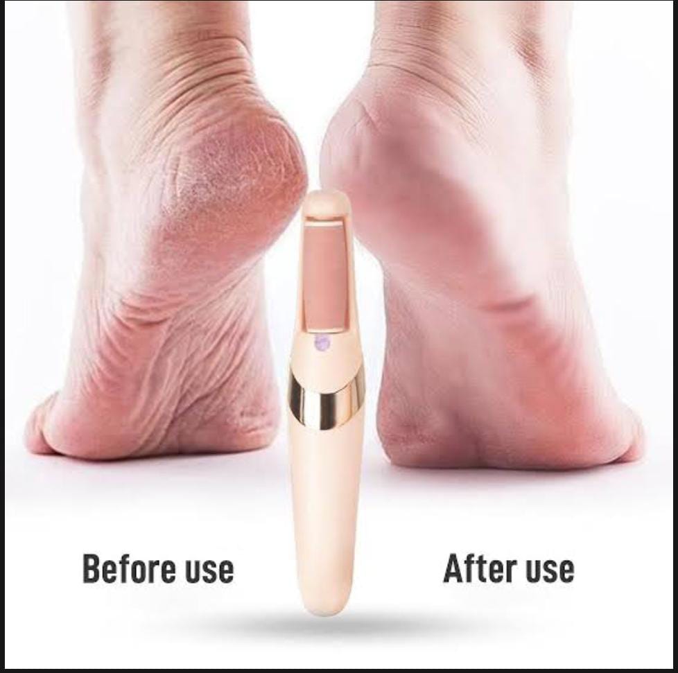 Flawless Pedi: Rechargeable Foot Smoother